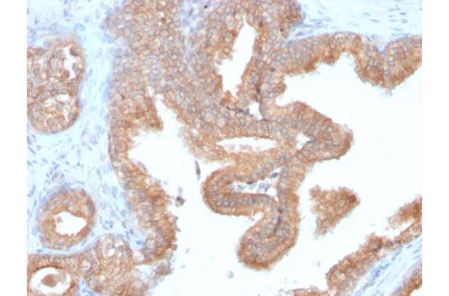 Immunohistochemistry - Anti-AMACR Antibody [AMACR/2748R] (A248617) - Antibodies.com