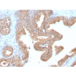 Immunohistochemistry - Anti-AMACR Antibody [AMACR/2748R] (A248617) - Antibodies.com