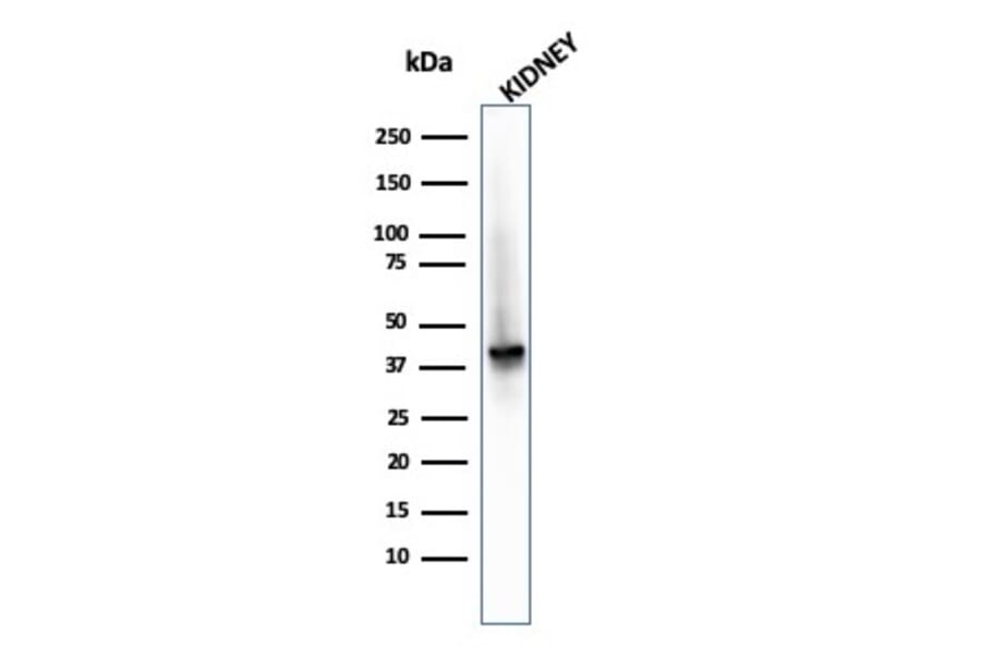 Western Blot - Anti-AMACR Antibody [AMACR/2748R] (A248618) - Antibodies.com