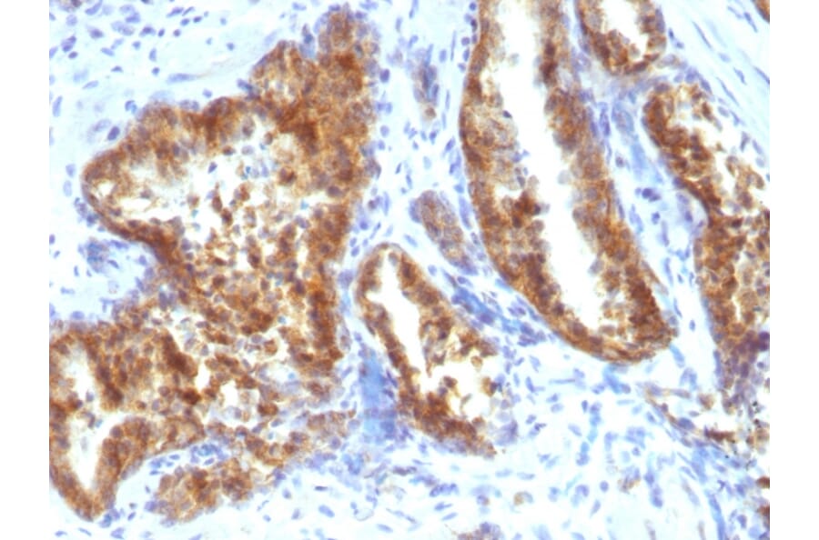 Immunohistochemistry - Anti-AMACR Antibody (A248619) - Antibodies.com