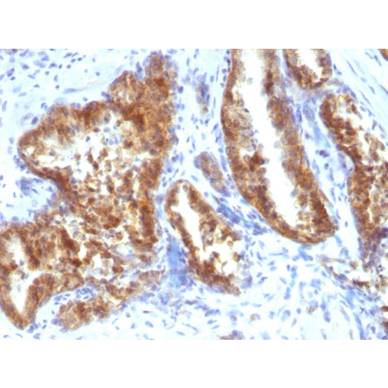 Immunohistochemistry - Anti-AMACR Antibody (A248619) - Antibodies.com