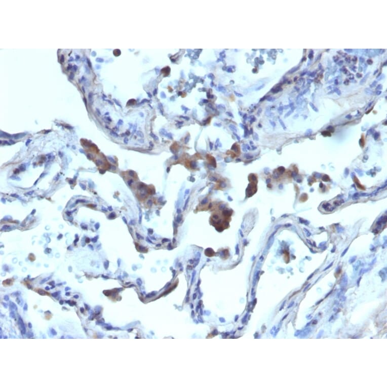 Immunohistochemistry - Anti-AMACR Antibody (A248618) - Antibodies.com