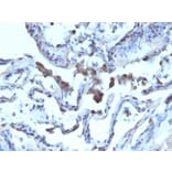 Immunohistochemistry - Anti-AMACR Antibody (A248618) - Antibodies.com