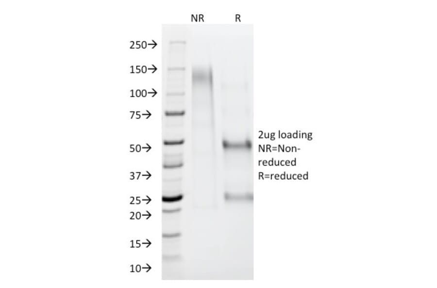 SDS-PAGE - Anti-AMACR Antibody (A248619) - Antibodies.com