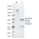 SDS-PAGE - Anti-AMACR Antibody (A248619) - Antibodies.com