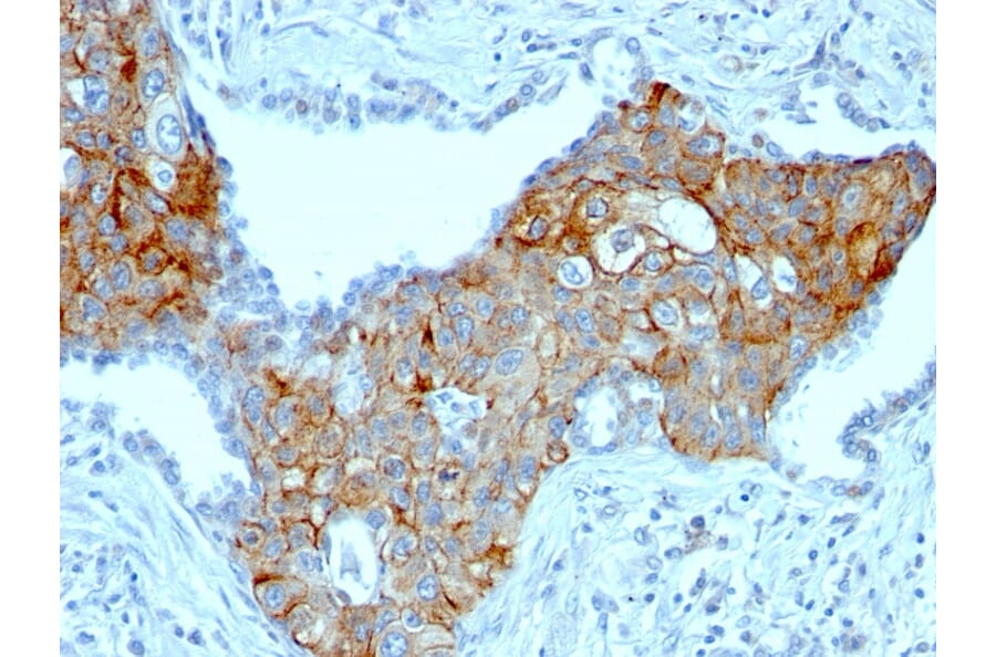 Immunohistochemistry - Anti-TRIM29 Antibody [TRIM29/1041] (A248620) - Antibodies.com