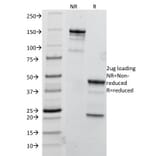 SDS-PAGE - Anti-TRIM29 Antibody [TRIM29/1041] (A248620) - Antibodies.com