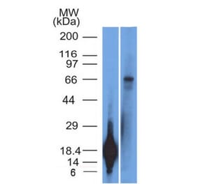 Western Blot - Anti-TRIM29 Antibody [TRIM29/1042] (A248621) - Antibodies.com
