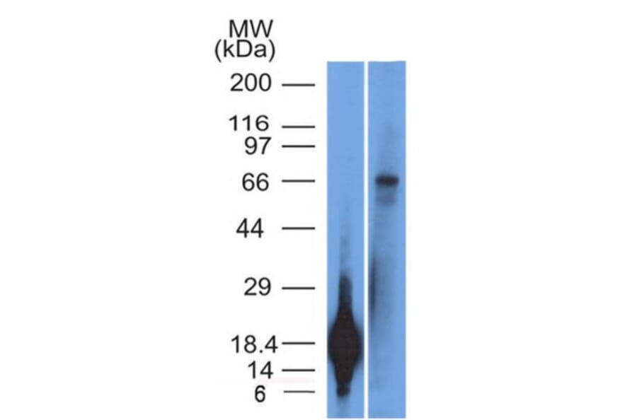 Western Blot - Anti-TRIM29 Antibody [TRIM29/1042] (A248621) - Antibodies.com