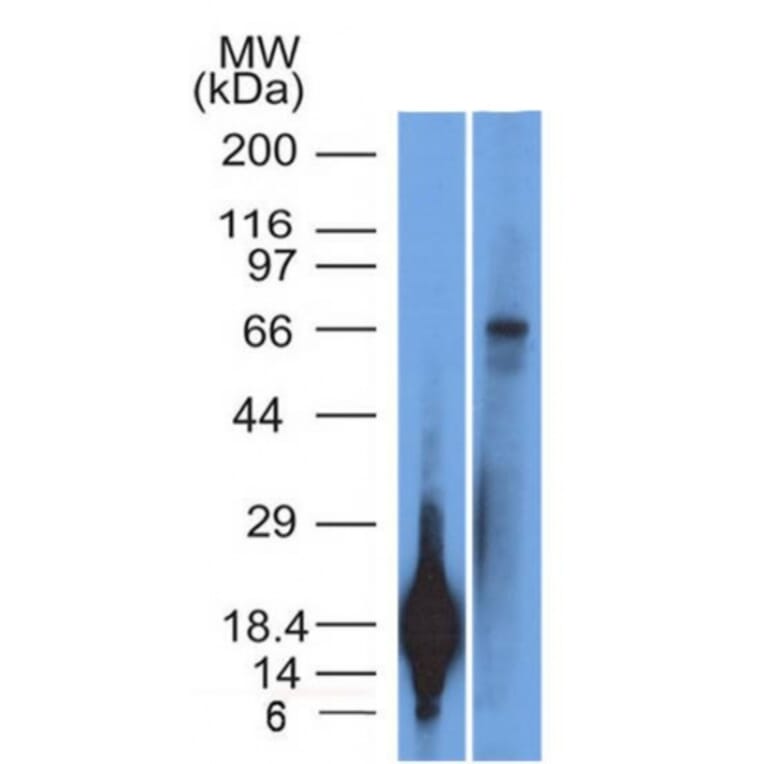 Western Blot - Anti-TRIM29 Antibody [TRIM29/1042] (A248621) - Antibodies.com