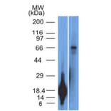 Western Blot - Anti-TRIM29 Antibody [TRIM29/1042] (A248621) - Antibodies.com