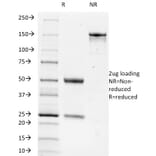 SDS-PAGE - Anti-TRIM29 Antibody [TRIM29/1042] (A248620) - Antibodies.com