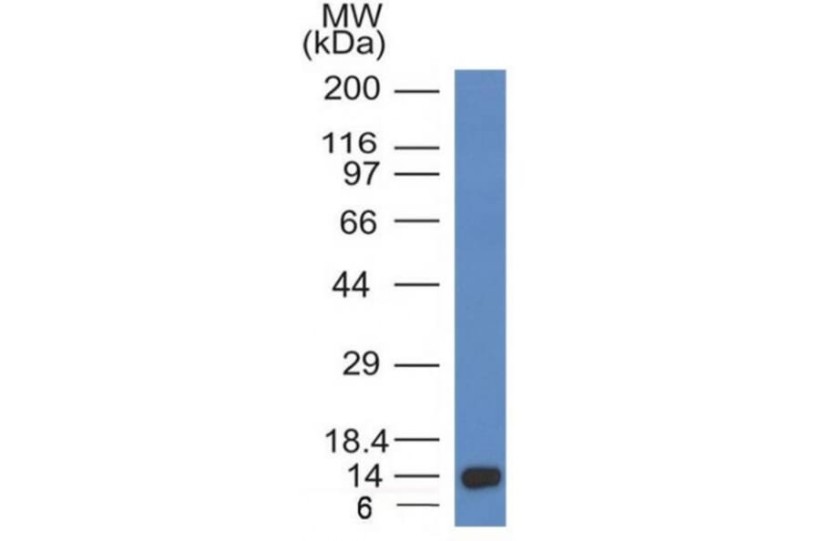 Western Blot - Anti-ALK Antibody [ALK/1032] (A248623) - Antibodies.com