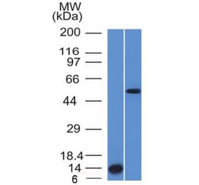 Western Blot - Anti-ALK Antibody [ALK/1503] (A248623) - Antibodies.com