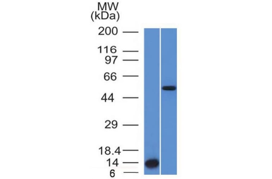 Western Blot - Anti-ALK Antibody [ALK/1503] (A248623) - Antibodies.com