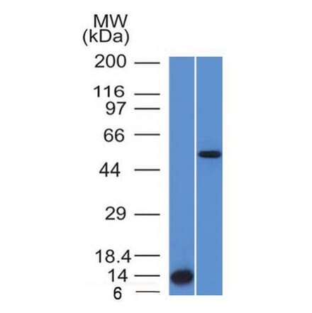 Western Blot - Anti-ALK Antibody [ALK/1503] (A248623) - Antibodies.com