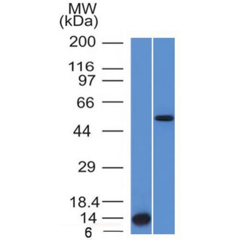 Western Blot - Anti-ALK Antibody [ALK/1503] (A248623) - Antibodies.com