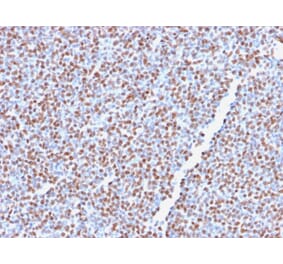 Immunohistochemistry - Anti-ALK Antibody [ALK1/2766R] (A248625) - Antibodies.com