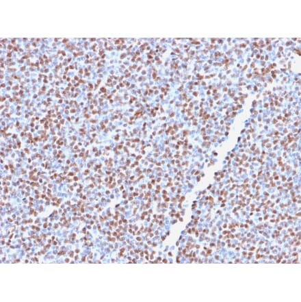 Immunohistochemistry - Anti-ALK Antibody [ALK1/2766R] (A248625) - Antibodies.com