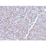 Immunohistochemistry - Anti-ALK Antibody [ALK1/2766R] (A248625) - Antibodies.com