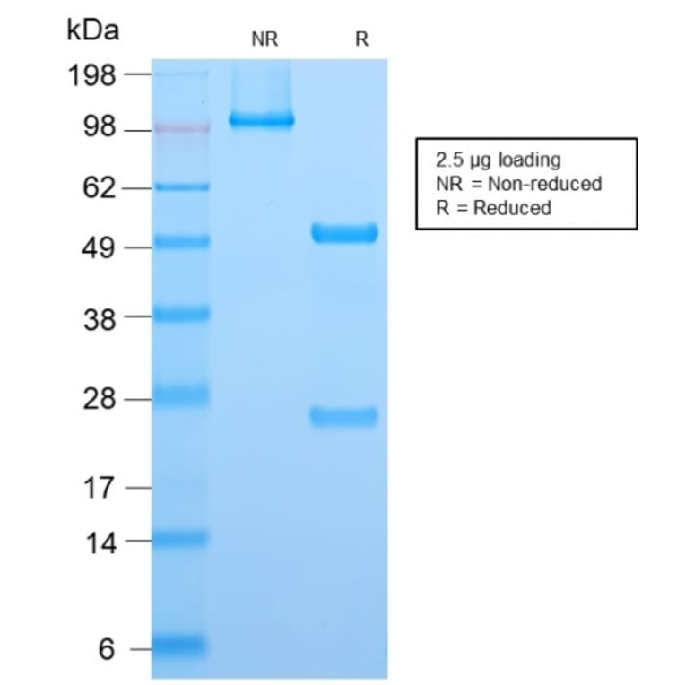 SDS-PAGE - Anti-ALK Antibody [ALK1/2766R] (A248626) - Antibodies.com