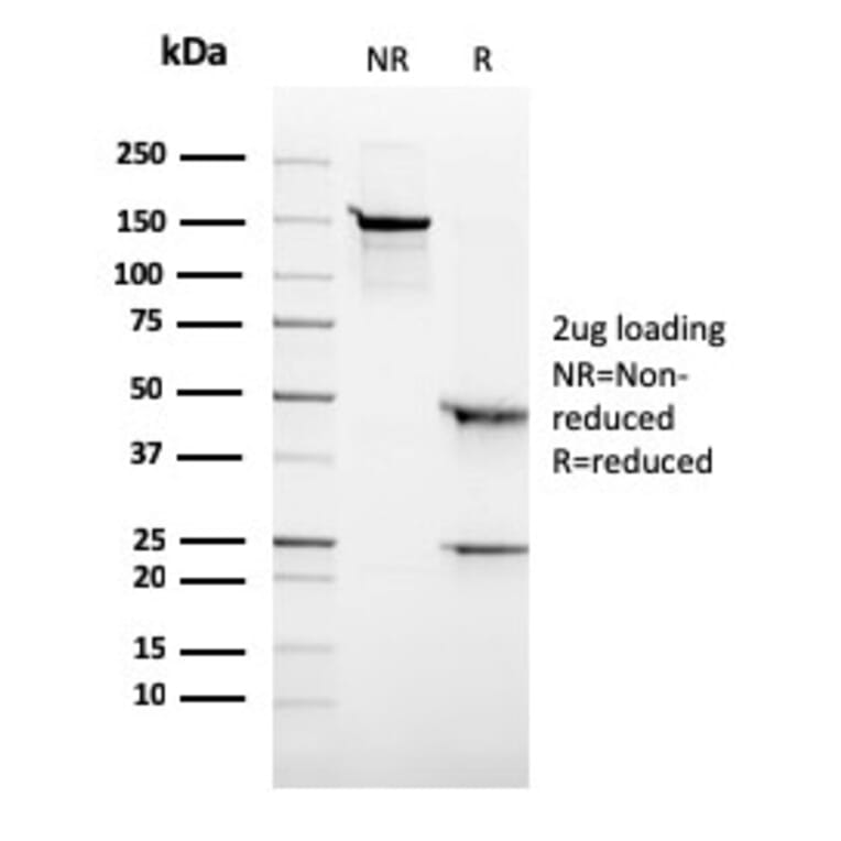 SDS-PAGE - Anti-ALK Antibody [ALK/3218R] (A248627) - Antibodies.com