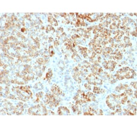 Immunohistochemistry - Anti-Frataxin Antibody [FXN/2124] (A248628) - Antibodies.com