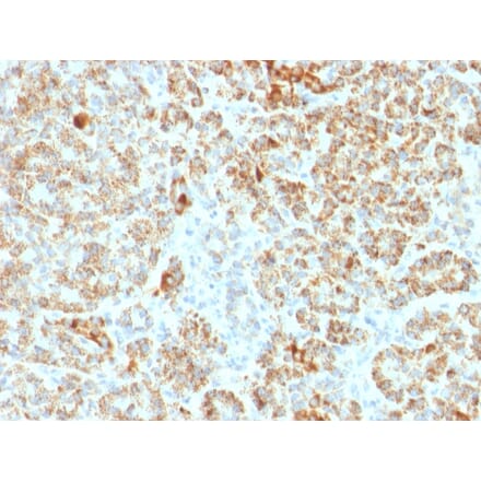 Immunohistochemistry - Anti-Frataxin Antibody [FXN/2124] (A248628) - Antibodies.com