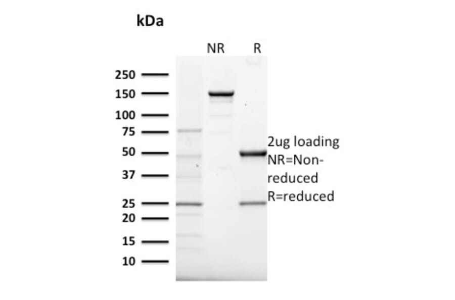 SDS-PAGE - Anti-Frataxin Antibody [FXN/2124] (A248628) - Antibodies.com
