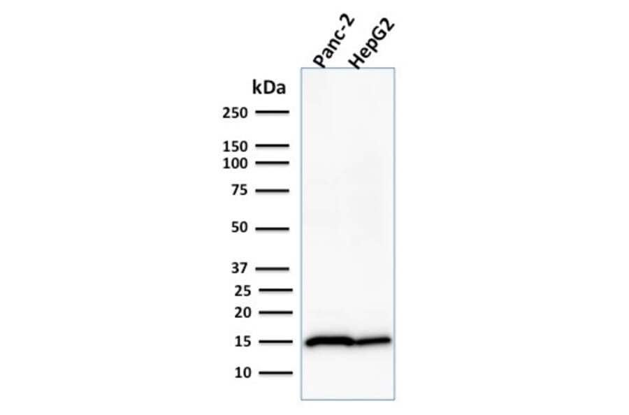 Western Blot - Anti-Frataxin Antibody [FXN/2124] (A248628) - Antibodies.com