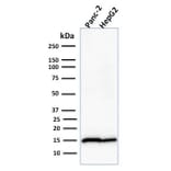 Western Blot - Anti-Frataxin Antibody [FXN/2124] (A248628) - Antibodies.com