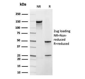 SDS-PAGE - Anti-Frataxin Antibody [rFXN/2124] (A248628) - Antibodies.com