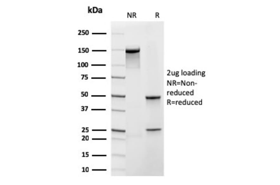 SDS-PAGE - Anti-Frataxin Antibody [rFXN/2124] (A248628) - Antibodies.com