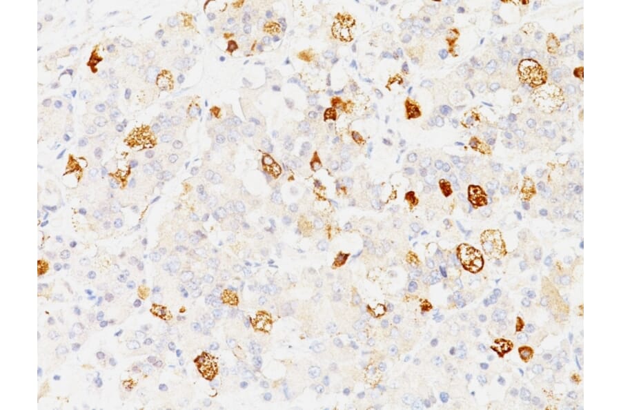 Immunohistochemistry - Anti-FSH beta Antibody [SPM107] (A248630) - Antibodies.com