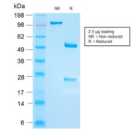 SDS-PAGE - Anti-FSH beta Antibody [FSHb/2033R] (A248632) - Antibodies.com