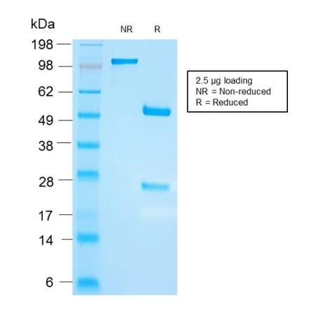 SDS-PAGE - Anti-FSH beta Antibody [FSHb/2033R] (A248632) - Antibodies.com