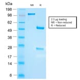 SDS-PAGE - Anti-FSH beta Antibody [FSHb/2033R] (A248632) - Antibodies.com