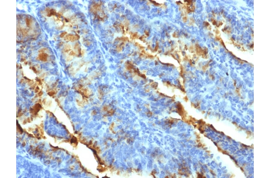 Immunohistochemistry - Anti-FSH Receptor Antibody [FSHR/1400] (A248632) - Antibodies.com