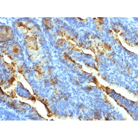 Immunohistochemistry - Anti-FSH Receptor Antibody [FSHR/1400] (A248632) - Antibodies.com