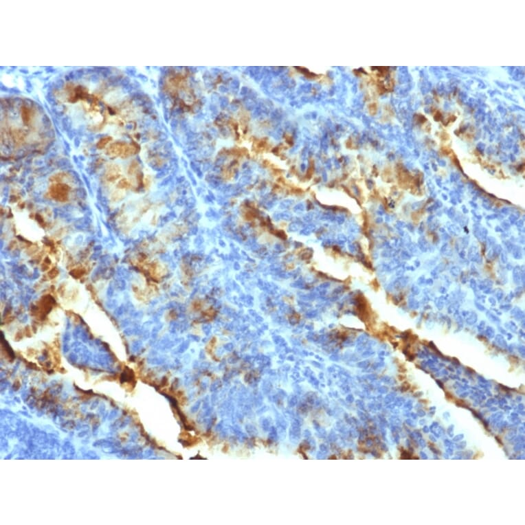 Immunohistochemistry - Anti-FSH Receptor Antibody [FSHR/1400] (A248632) - Antibodies.com