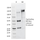 SDS-PAGE - Anti-FSH Receptor Antibody [FSHR/1400] (A248633) - Antibodies.com