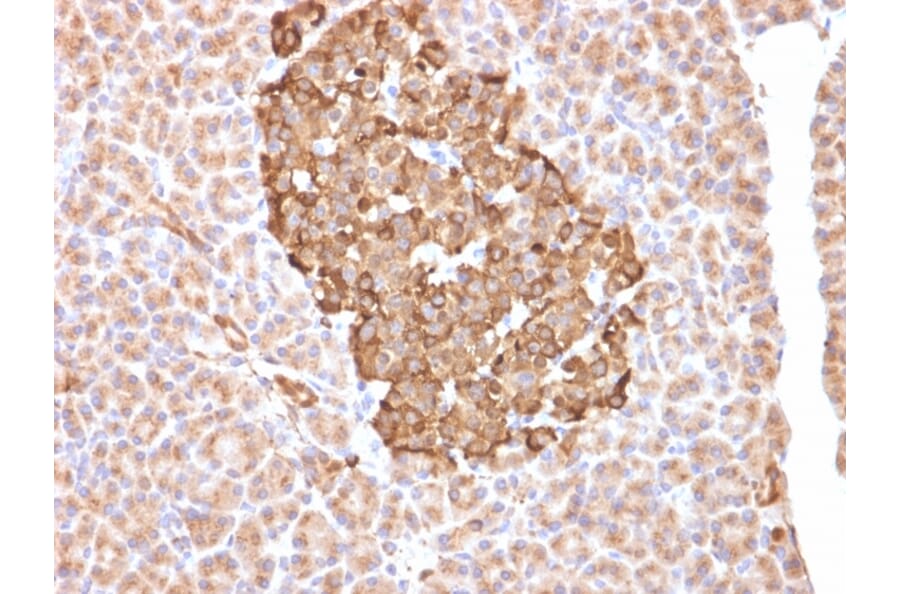 Immunohistochemistry - Anti-Ferritin Heavy Chain Antibody [FTH/2081] (A248634) - Antibodies.com