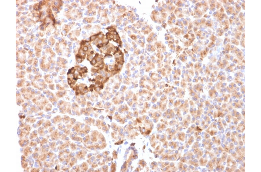 Immunohistochemistry - Anti-Ferritin Heavy Chain Antibody [FTH/2081] (A248633) - Antibodies.com