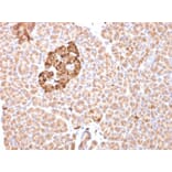 Immunohistochemistry - Anti-Ferritin Heavy Chain Antibody [FTH/2081] (A248633) - Antibodies.com