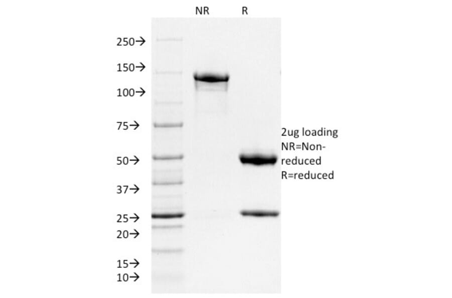 SDS-PAGE - Anti-Ferritin Heavy Chain Antibody [FTH/2081] (A248634) - Antibodies.com