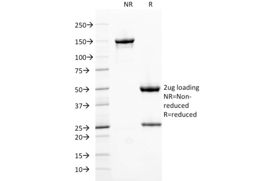 SDS-PAGE - Anti-Ferritin Heavy Chain Antibody [FTH/2082] (A248635) - Antibodies.com