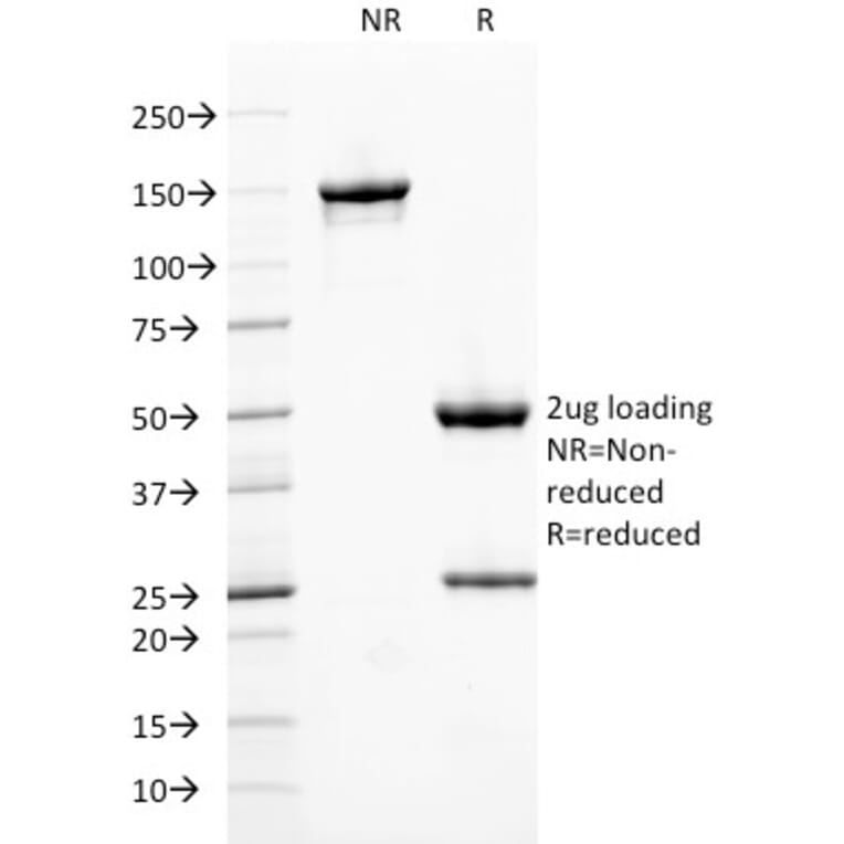 SDS-PAGE - Anti-Ferritin Heavy Chain Antibody [FTH/2082] (A248635) - Antibodies.com