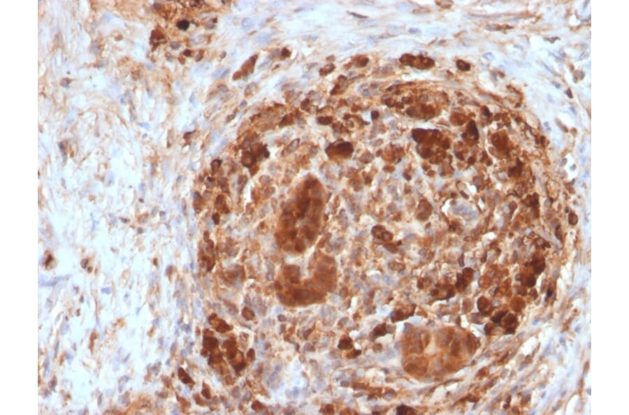 Immunohistochemistry - Anti-Ferritin Heavy Chain Antibody [FTH/2082] (A248634) - Antibodies.com