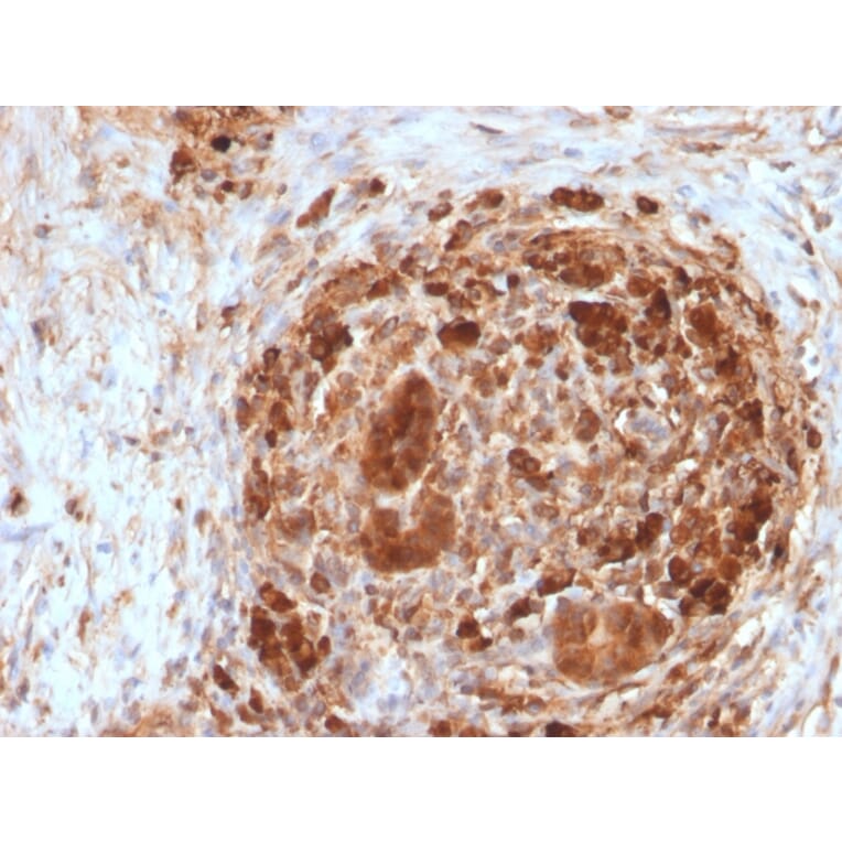 Immunohistochemistry - Anti-Ferritin Heavy Chain Antibody [FTH/2082] (A248634) - Antibodies.com