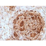 Immunohistochemistry - Anti-Ferritin Heavy Chain Antibody [FTH/2082] (A248634) - Antibodies.com